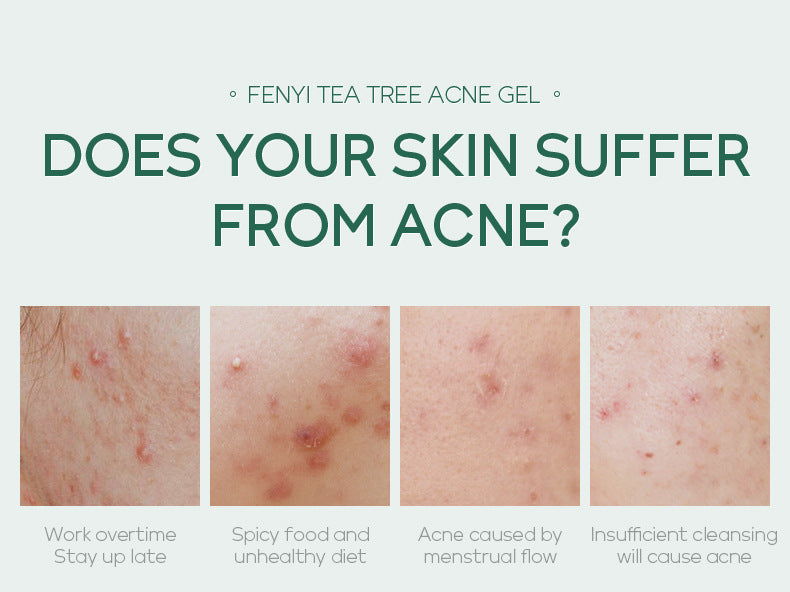 Moisturizing Skin Care Products 20g